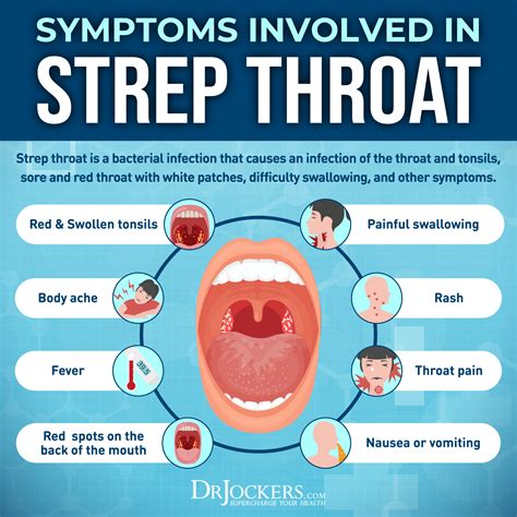 Strep Throat: Symptoms, Causes, Diagnosis & Treatment.